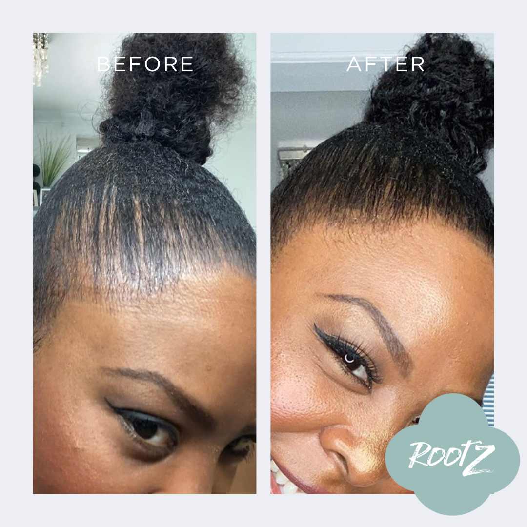 RootZ before and after #colour_black