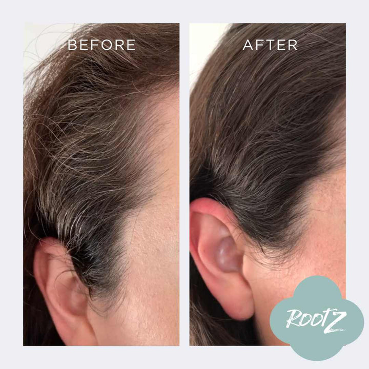 RootZ before and after #colour_dark-brown