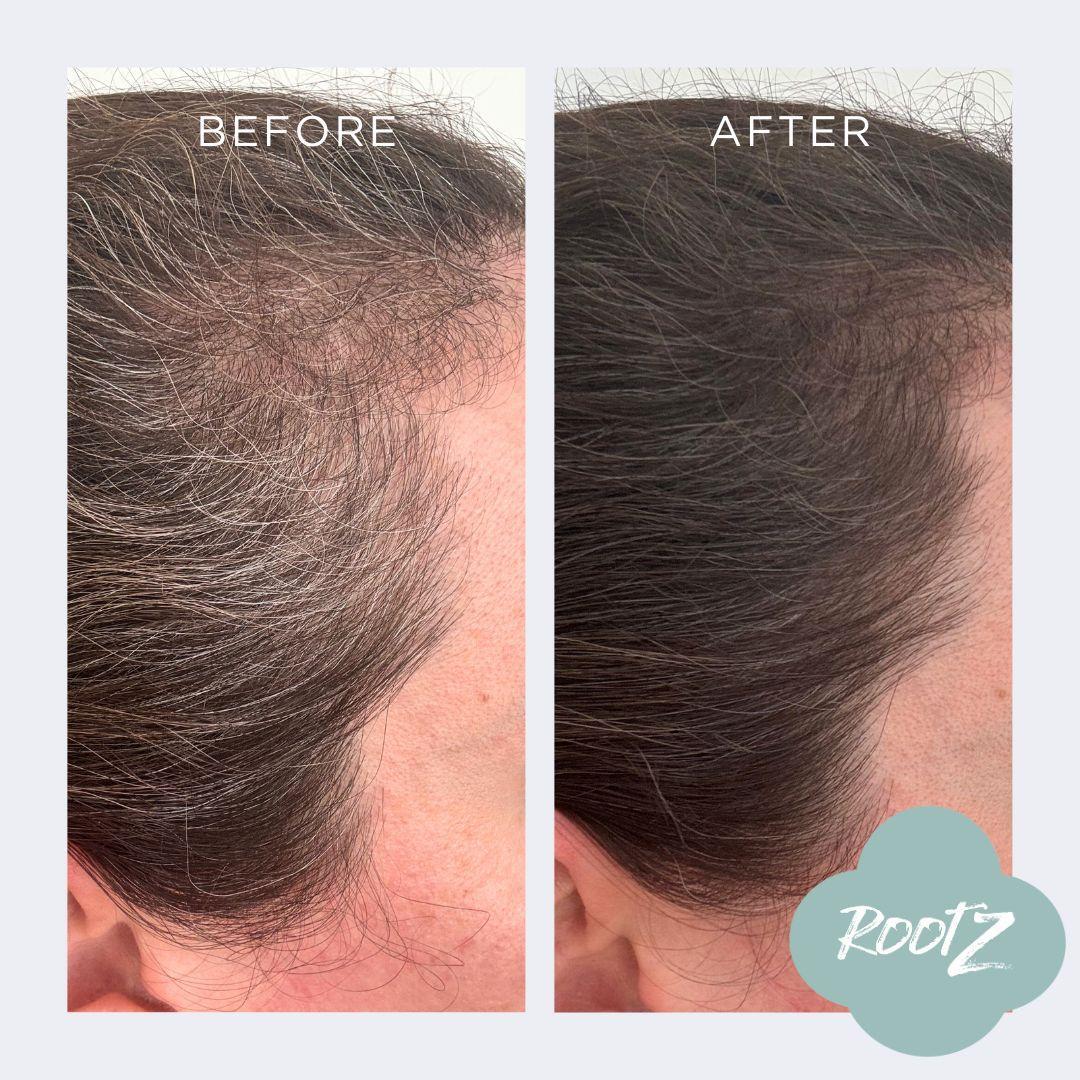 RootZ before and after #colour_deep-dark-brown
