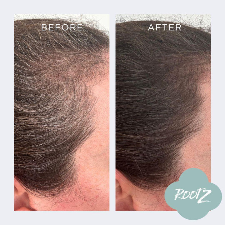 RootZ before and after #colour_deep-dark-brown