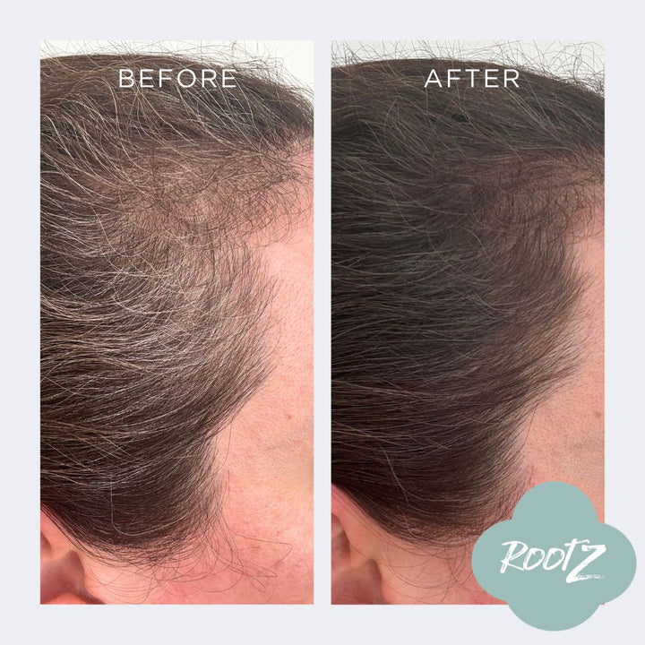 RootZ Before and After #colour_deep-dark-brown