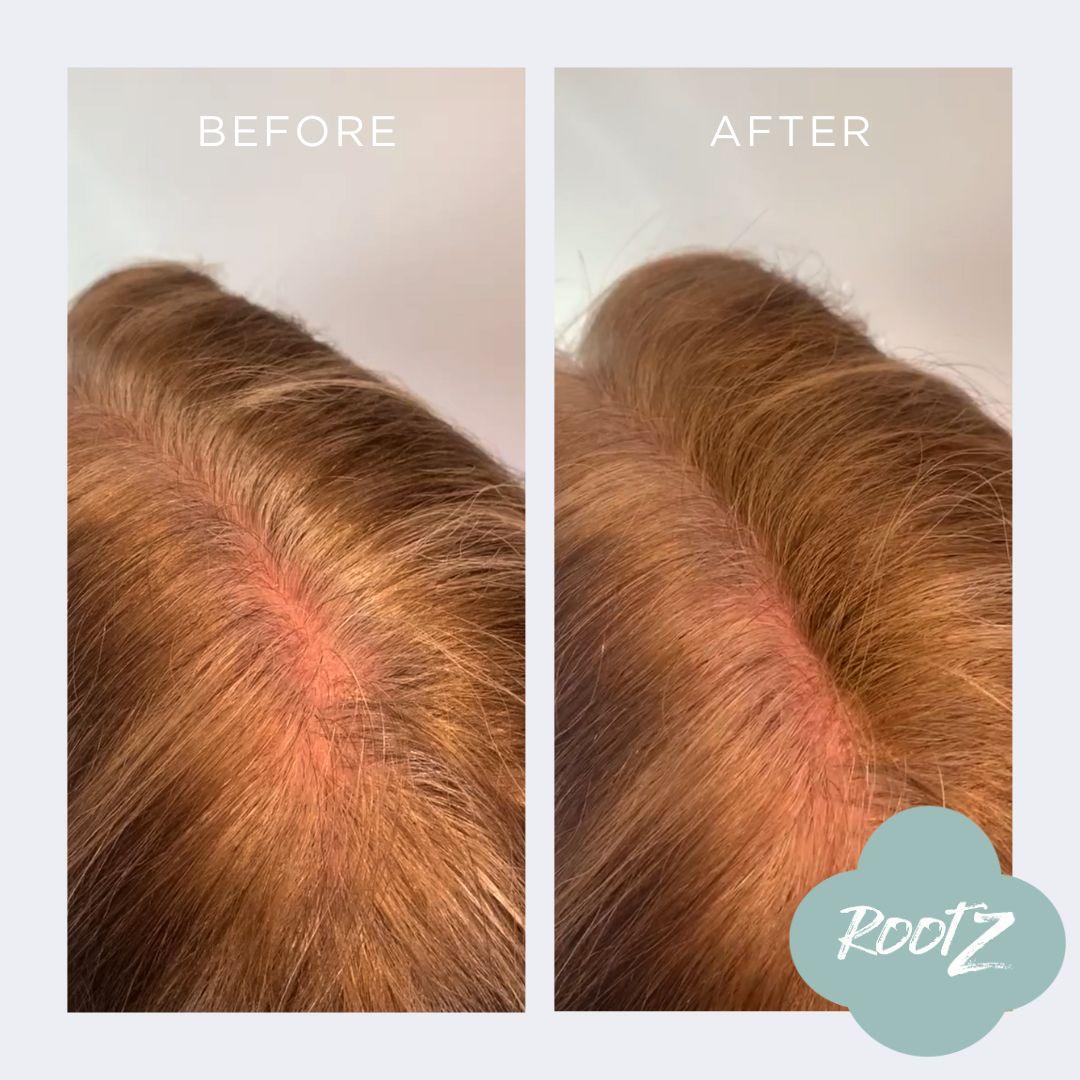 RootZ before and after #colour_light-brown