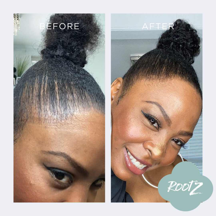 RootZ Before and after #colour_black