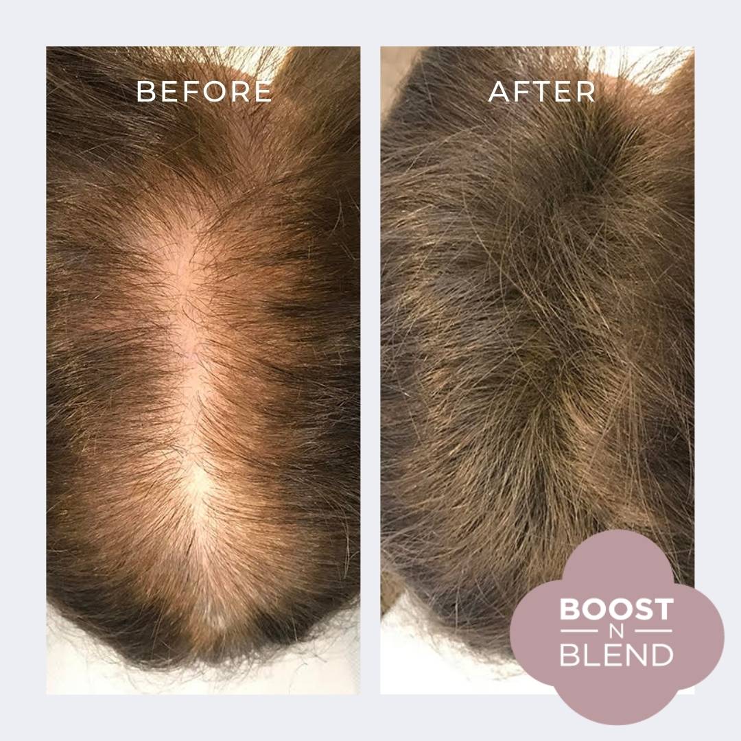Smooth Medium Brown Boost N Blend Hair Fibres Before and After